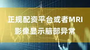 正规配资平台或者MRI影像显示脑部异常